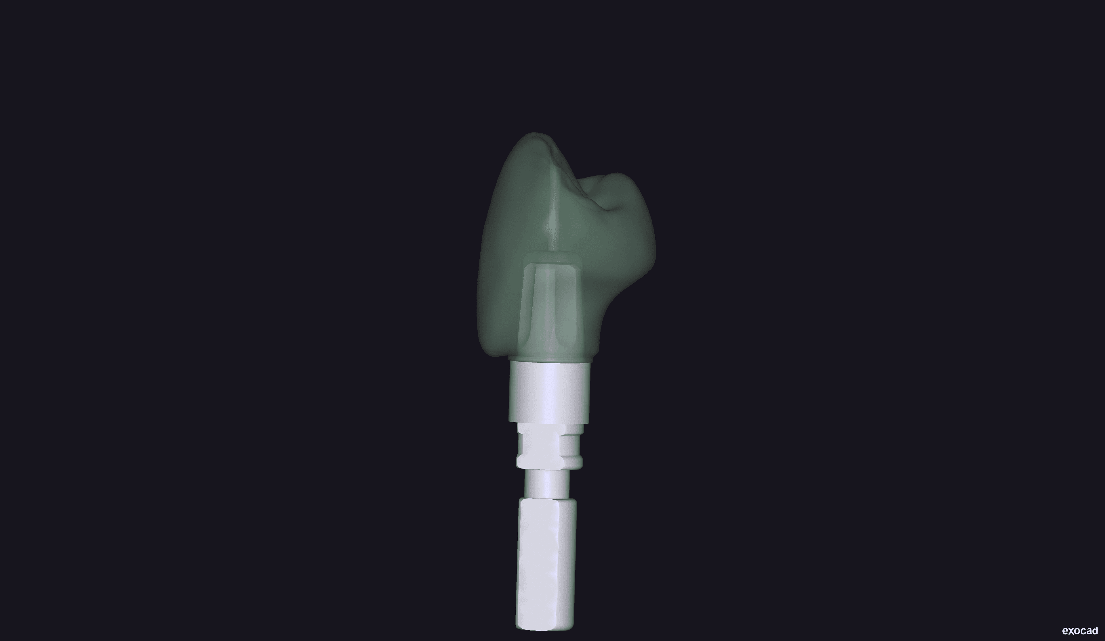 Initial scan showing implant position and swollen gingiva