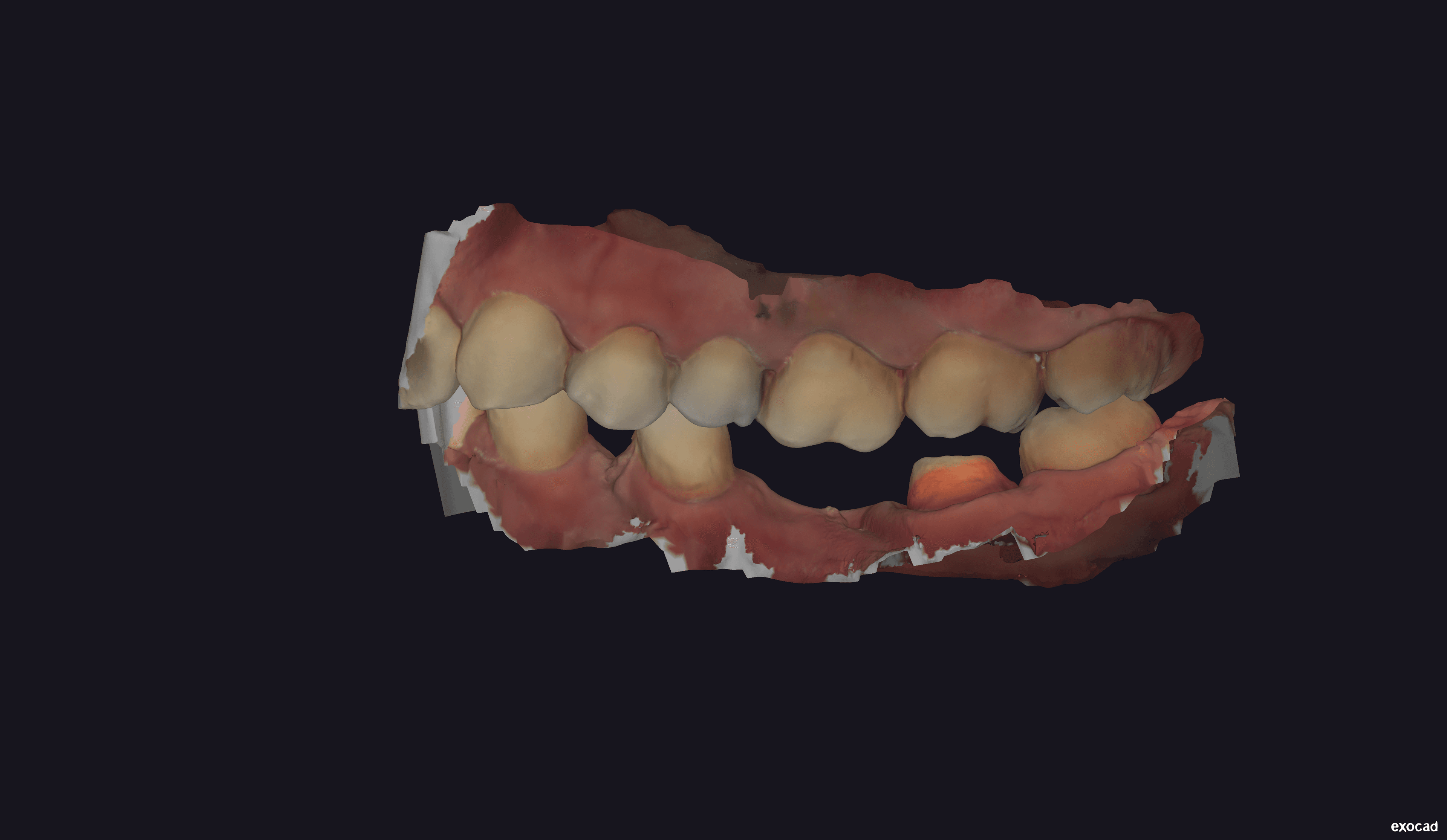 Initial Itero scan - View 1