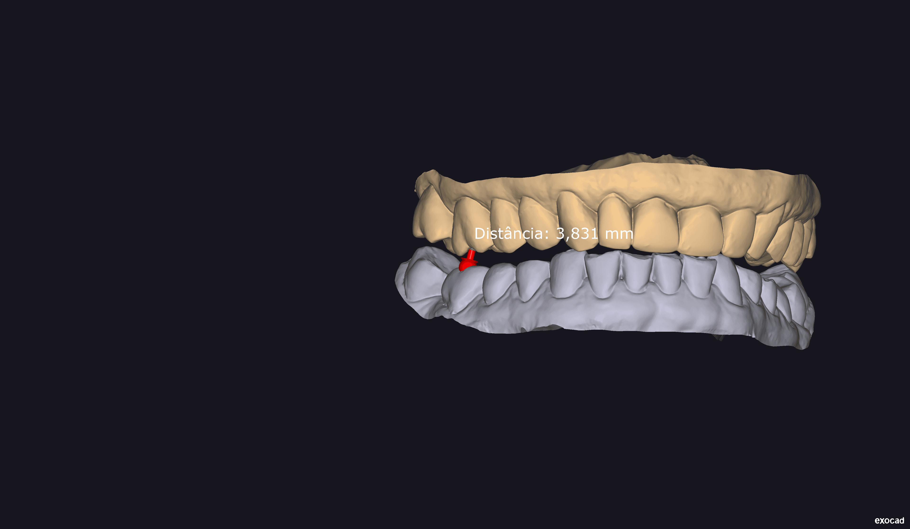 STL File Example