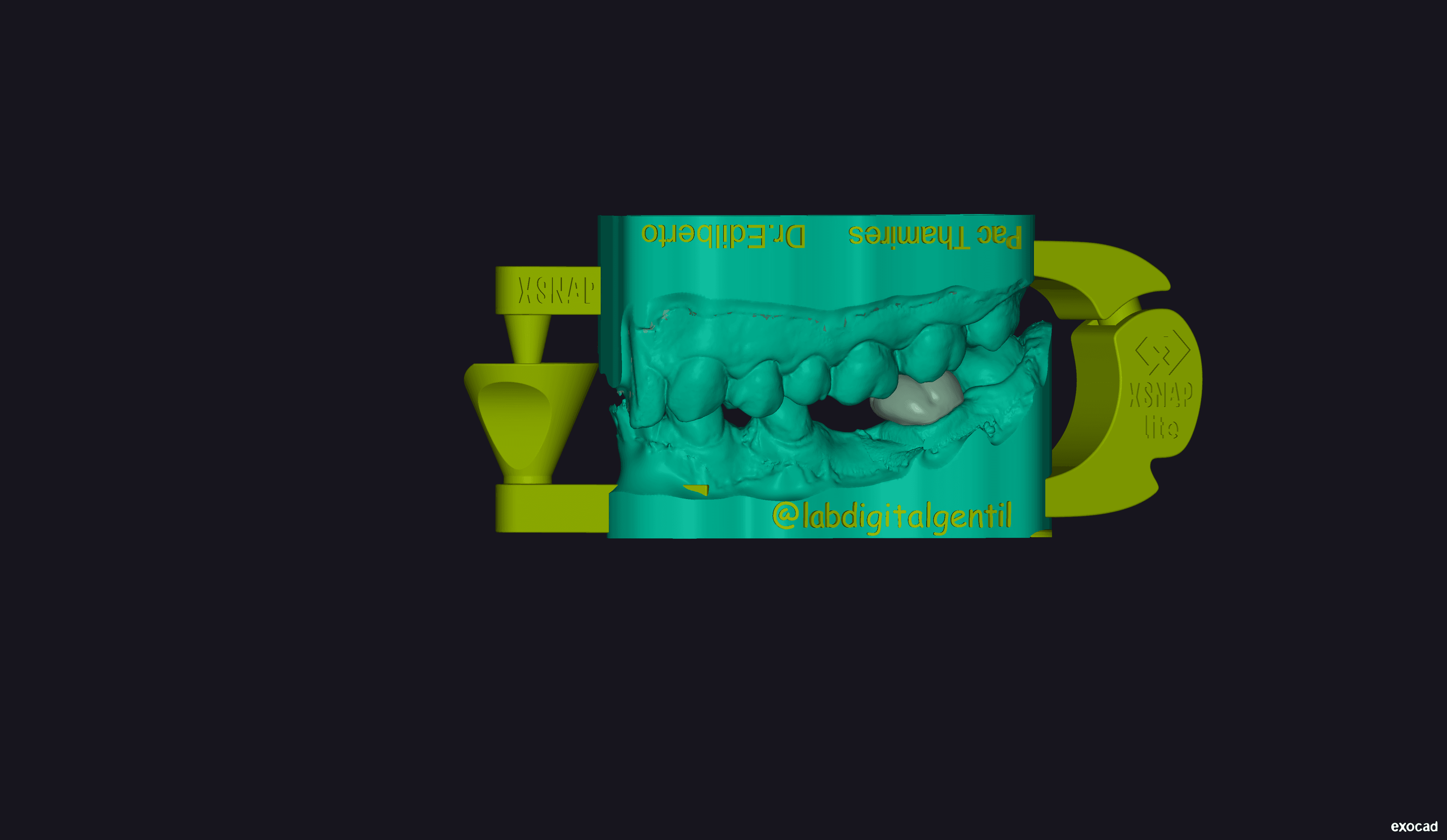Final model of unitary crown for element 36