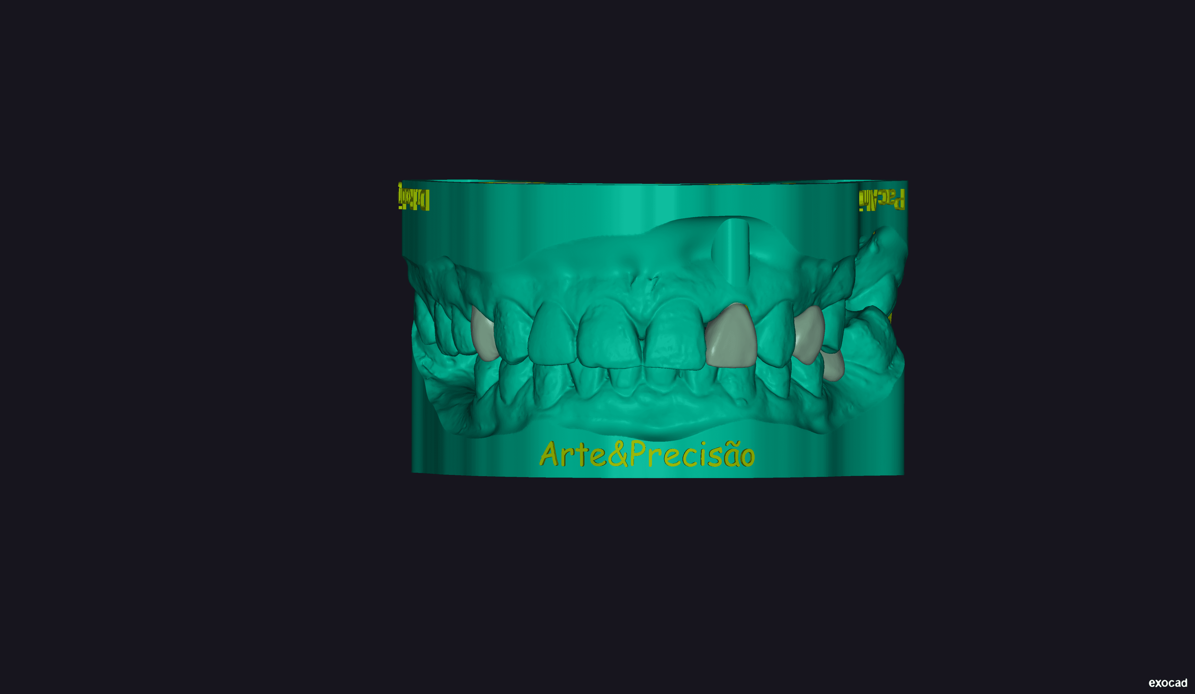 Final case of the crowns